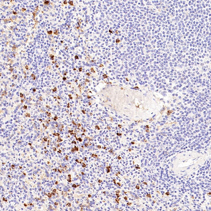 CD14 Mouse mAb (SDT-411-1)