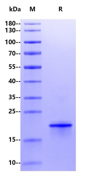 TNF-alpha His Tag Protein, Human