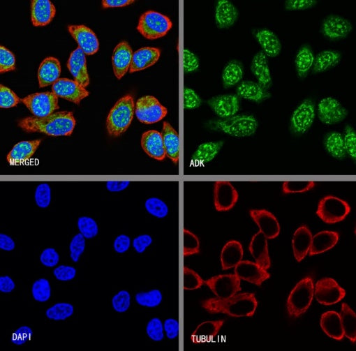 ADK Rabbit Polyclonal Antibody