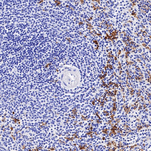 CD163 Recombinant Rabbit mAb (SDT-222-171)