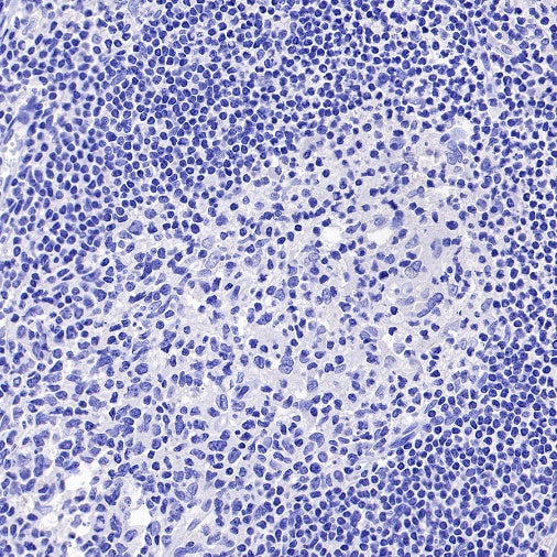 ROR1 Recombinant Rabbit mAb (SDT-R502)