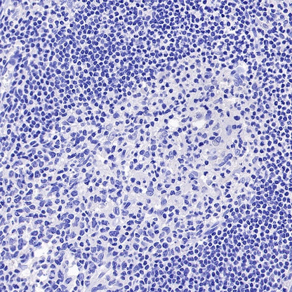 ROR1 Recombinant Rabbit mAb (SDT-R502)