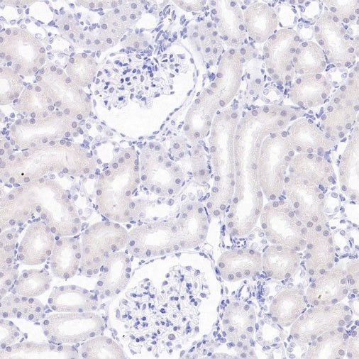 DAZL Recombinant Rabbit mAb (S-3113-35)