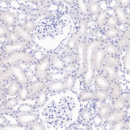 DAZL Recombinant Rabbit mAb (S-3113-35)