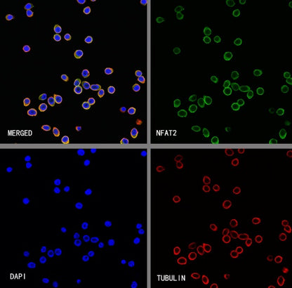 NFAT2 Recombinant Mouse mAb (S-4705)