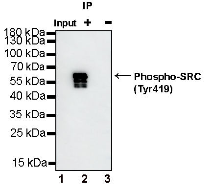 Phospho-SRC (Tyr419) Recombinant Rabbit mAb (S-1182-5)