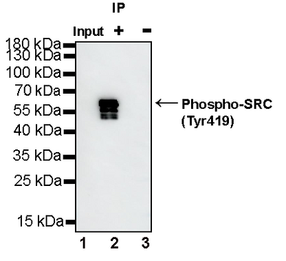 Phospho-SRC (Tyr419) Recombinant Rabbit mAb (S-1182-5)