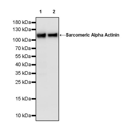 Sarcomeric Alpha Actinin Recombinant Rabbit mAb (S-1652-40)