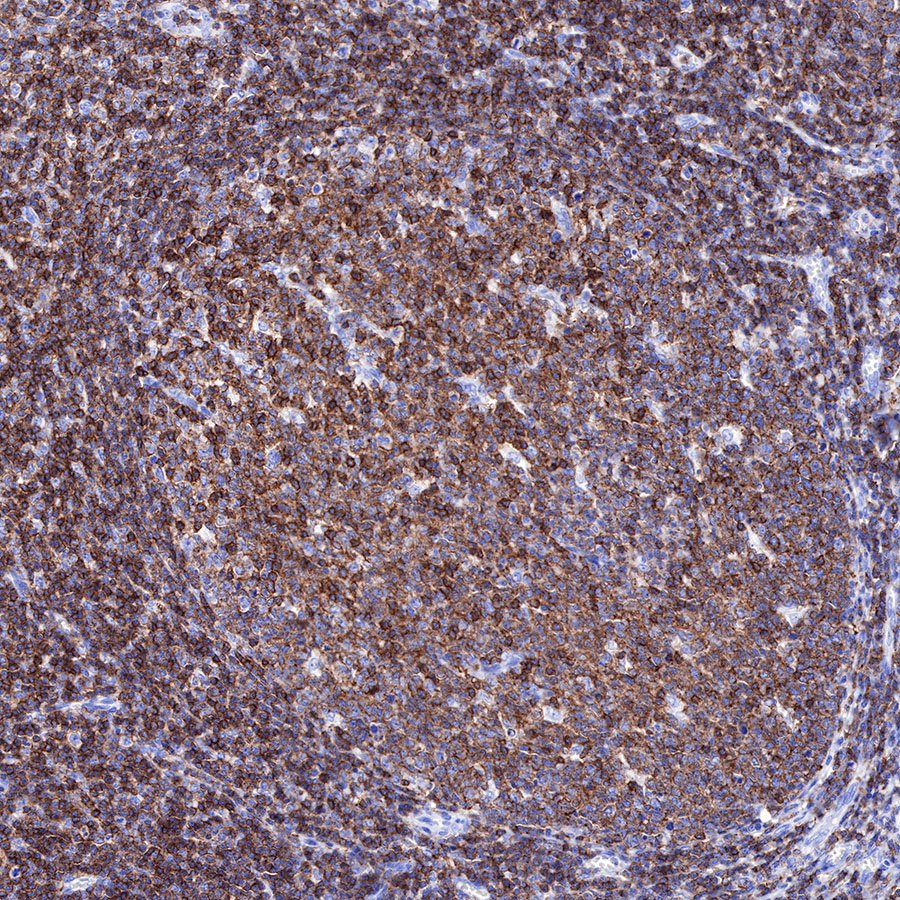 S-RMab® CD45 Recombinant Rabbit mAb,PBS Only (SDT-R035)