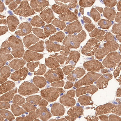 Alpha B Crystallin Recombinant Rabbit mAb (S-R216)
