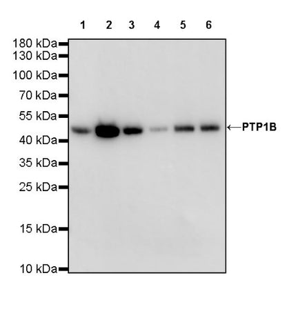 PTP1B Recombinant Rabbit mAb (S-R304)