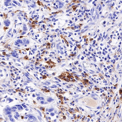 GPNMB Recombinant Rabbit mAb (S-R241)
