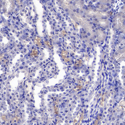 TRIM21 Mouse mAb (S-M0045)