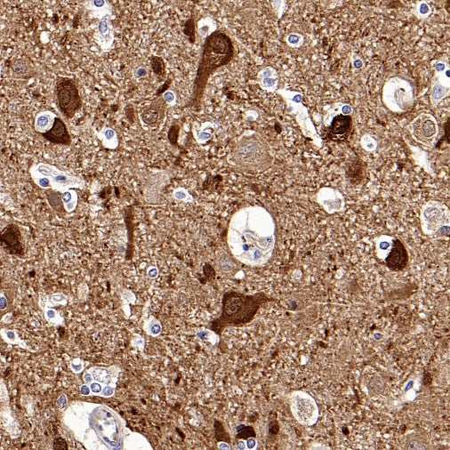 NRGN Recombinant Rabbit mAb (S-1624-60)