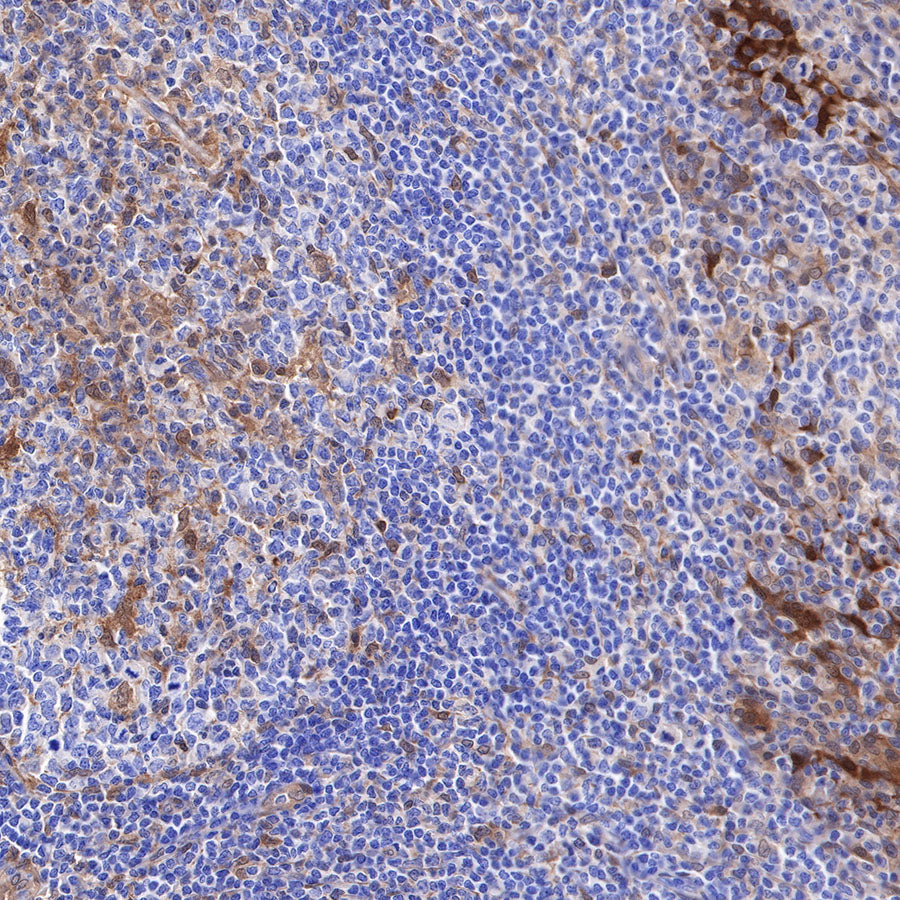 Galectin-3 Recombinant Rabbit mAb (SDT-370-111)