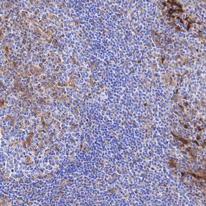 Galectin-3 Recombinant Rabbit mAb (SDT-370-111)