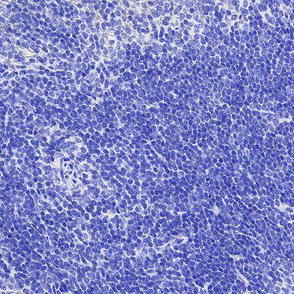 SLC5A1/SGLT1 Recombinant Rabbit mAb (S-4122-30)
