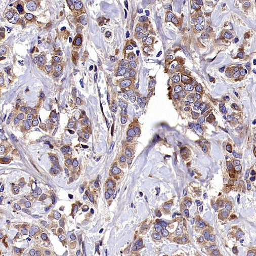 SQLE Recombinant Rabbit mAb (S-2358-207)