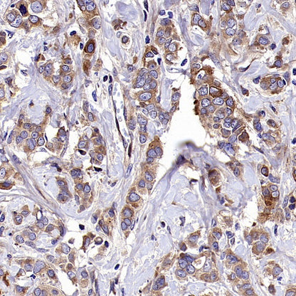 SQLE Recombinant Rabbit mAb (S-2358-207)