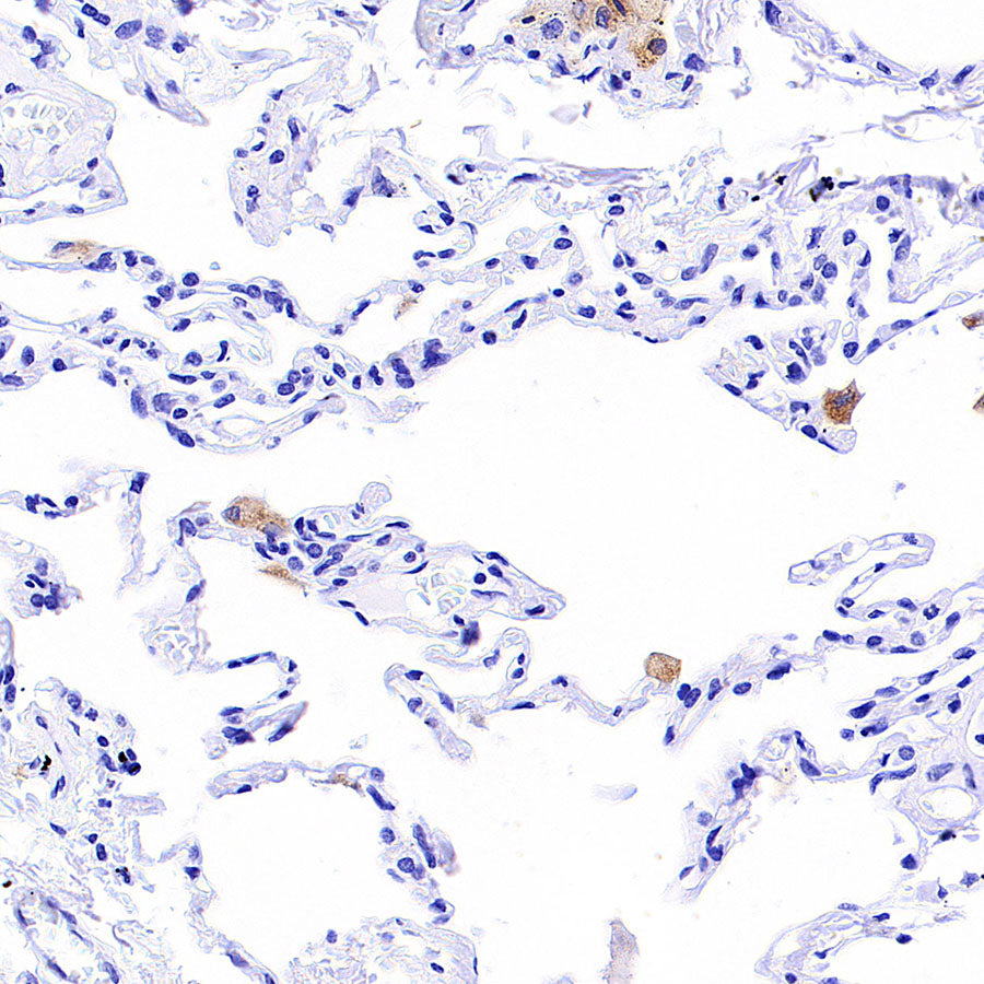 Tartrate Resistant Acid Phosphatase Recombinant Rabbit mAb (S-5960)