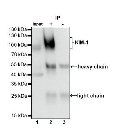 KIM-1 Recombinant Rabbit mAb (S-932-2)