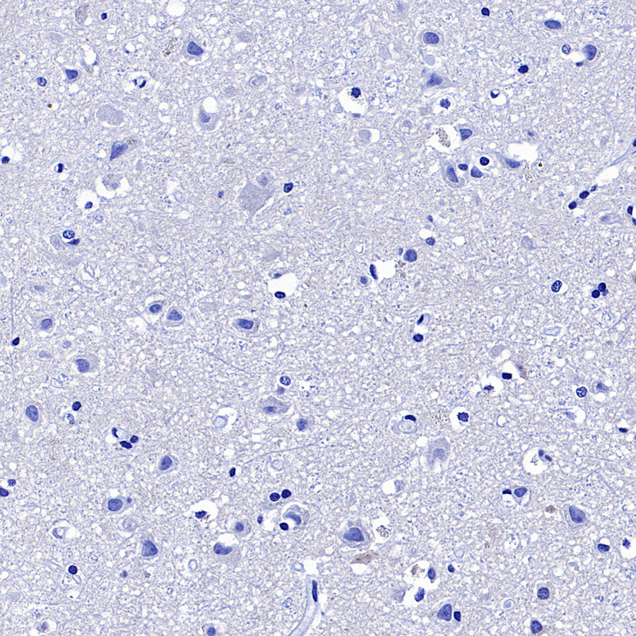 CD127 Recombinant Rabbit mAb (S-4826)