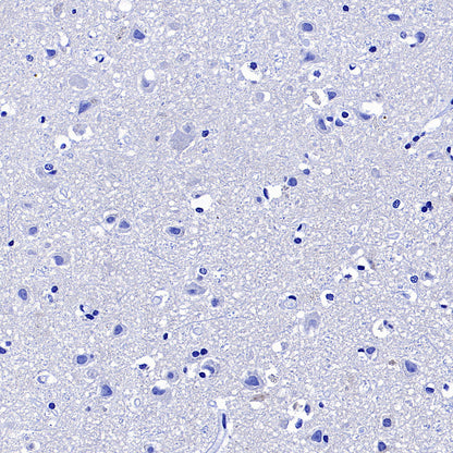 CD127 Recombinant Rabbit mAb (S-4826)