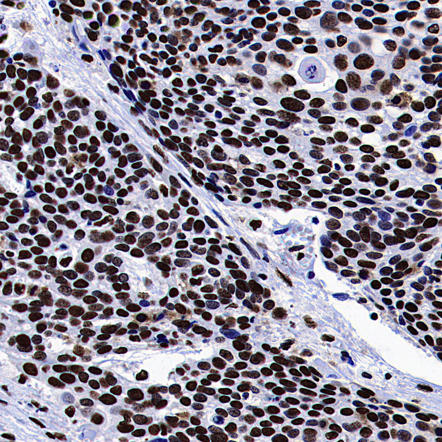 ZMYND8 Recombinant Rabbit mAb (S-5407)