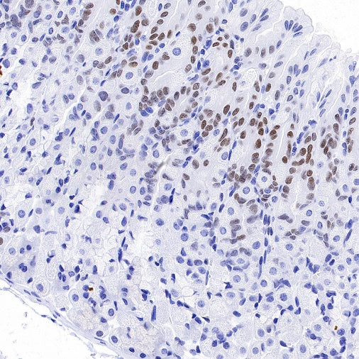 JunB Recombinant Rabbit mAb (S-670-242)