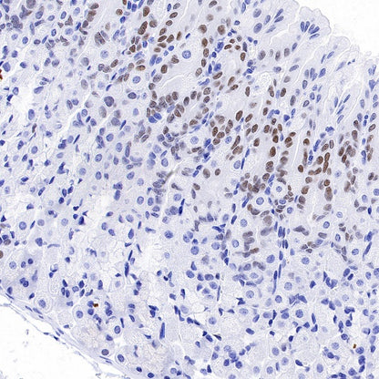 JunB Recombinant Rabbit mAb (S-670-242)