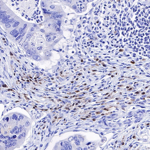 IRF4 Recombinant Rabbit mAb (S-654-33)