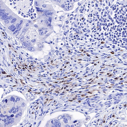 IRF4 Recombinant Rabbit mAb (S-654-33)