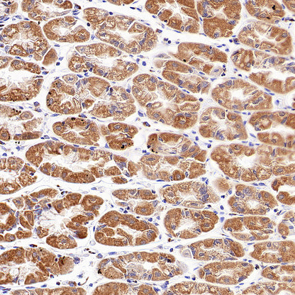 TOM20 Recombinant Rabbit mAb (S-M0015)