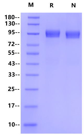 G-CSFR/CD114 His Tag Protein, Mouse