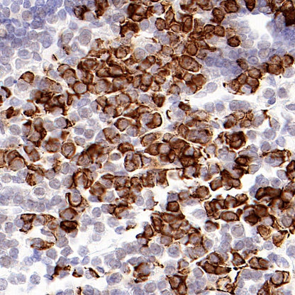 Prolactin/PRL Recombinant Rabbit mAb (S-235-215)
