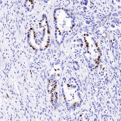 Topoisomerase II alpha Recombinant Rabbit mAb (S-513-7)