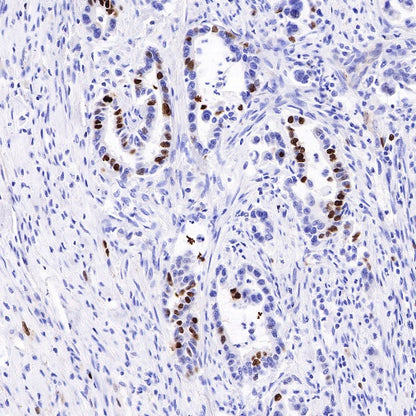 Topoisomerase II alpha Recombinant Rabbit mAb (S-513-7)