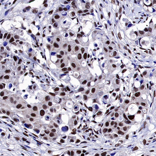 Estrogen Receptor β Recombinant Rabbit mAb (S-1396-67）
