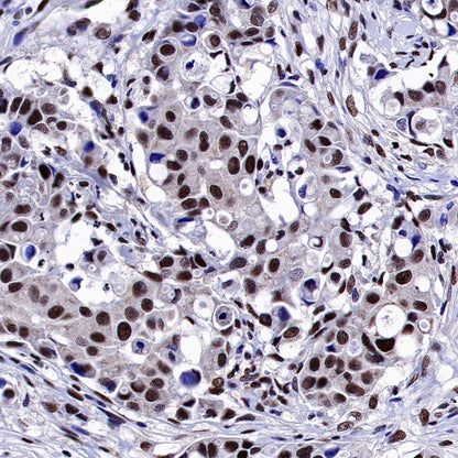 Estrogen Receptor β Recombinant Rabbit mAb (S-1396-67）