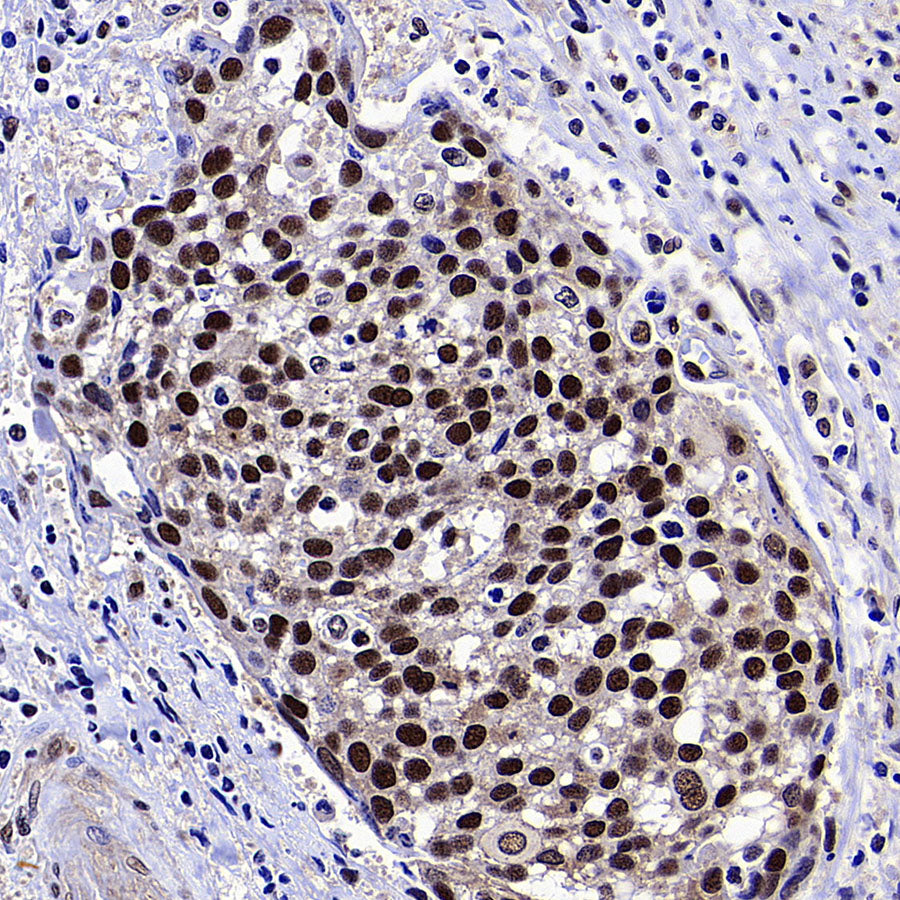 METTL1 Recombinant Rabbit mAb (S-4435-6)