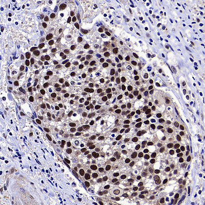 METTL1 Recombinant Rabbit mAb (S-4435-6)