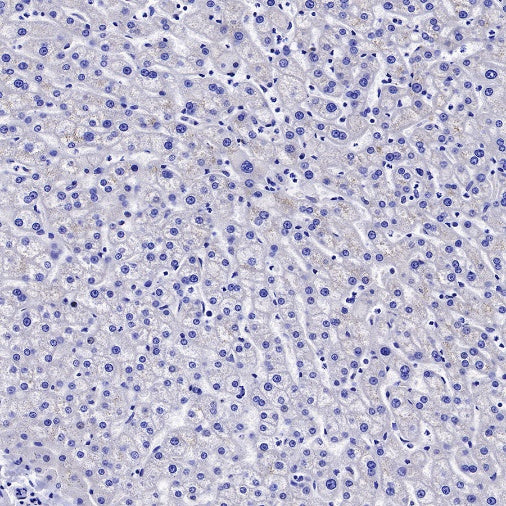 Neurofilament M Recombinant Rabbit mAb (S-501-31)