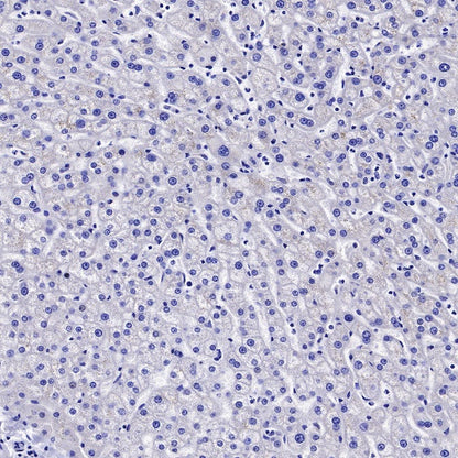 Neurofilament M Recombinant Rabbit mAb (S-501-31)