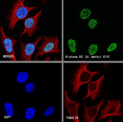 Histone H3 (di methyl K14) Recombinant Rabbit mAb (S-R414)