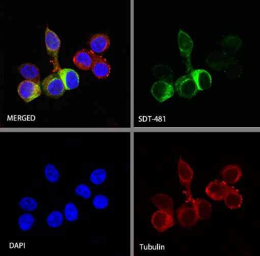 TFF1 Recombinant Rabbit mAb (S-481-16)