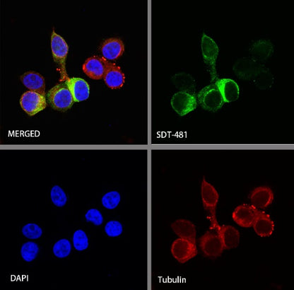 TFF1 Recombinant Rabbit mAb (S-481-16)