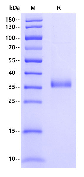 Human DcR3 Protein, His Tag