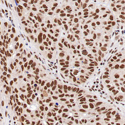 SF3B1 Rabbit Polyclonal Antibody