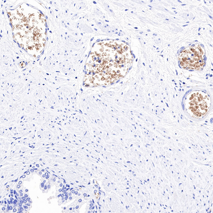 Hemoglobin Recombinant Rabbit mAb (SDT-193-71)