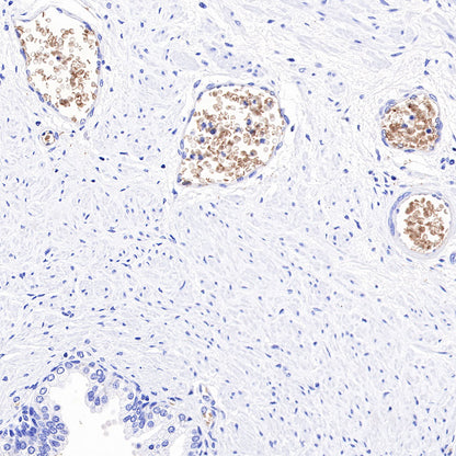 Hemoglobin Recombinant Rabbit mAb (SDT-193-71)